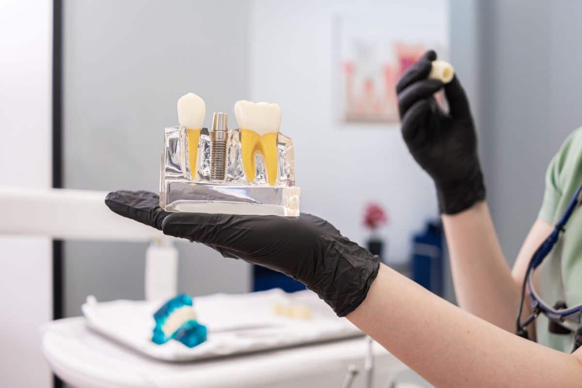 what to expect from dental implant surgery