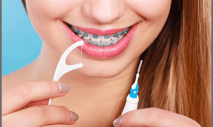Featured image for “Dental Hygienist Tips for Teens With Braces”