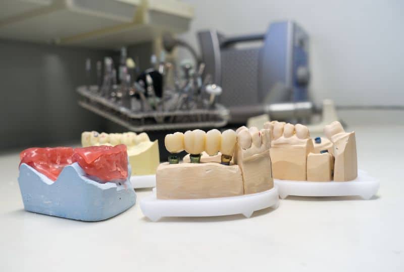 Dental Crowns - Restore Your Smile's Brilliance With Expert Care!