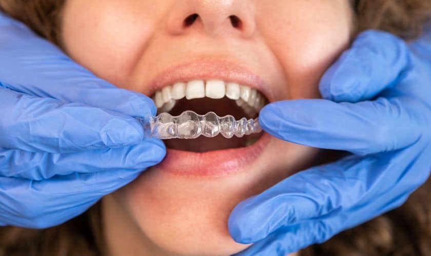 Featured image for “New Year, New Smile: Transforming Your Confidence With Invisalign”