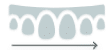 Dental crowns displayed in a row showing different stages or styles of tooth restoration.