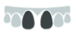 Tooth shade guide showing multiple dental crown color options for matching natural teeth.